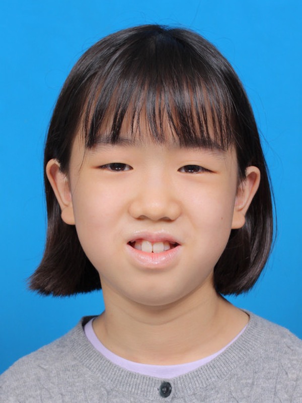 Lee, Xin Rui Alicia
